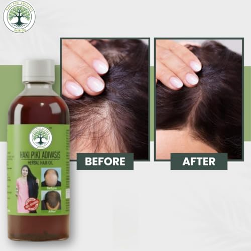 Image of Original Adivasis Hair Growth Oil 2 x 125 ml,Anti‑Hairfall & Anti‑Dandruff with Onion, Castor, Rosemary, Coconut, Amla, Bhringraj & Brahmi |for Men & Women (Pack of 2)