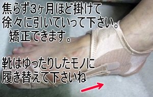 Amazon | 外反母趾予防サポーター ぼっち君 Lサイズ（25.5cm～28cm
