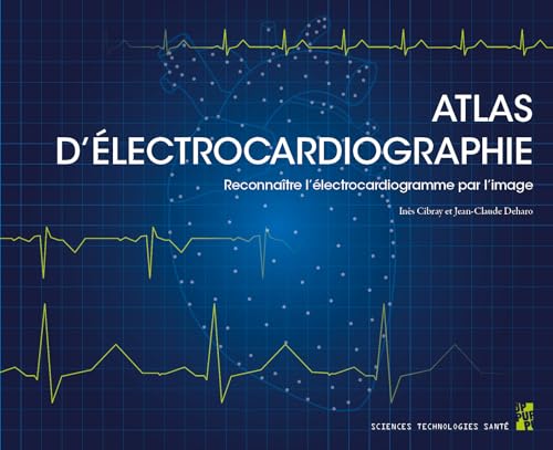 Atlas d’électrocardiographie: Reconnaître l’électrocardiogramme par l’image