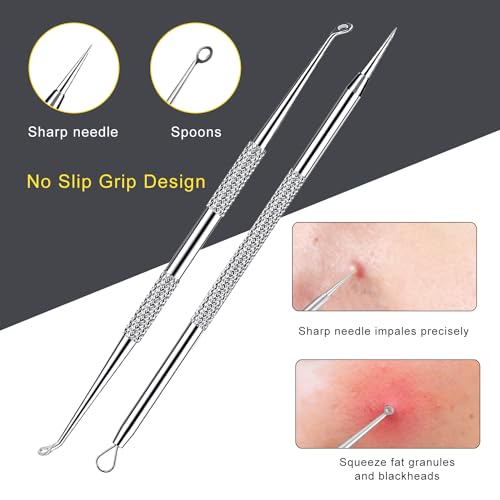 Blackhead-Remover-Tool-Boxoyx-10-Pcs-Professional-Pimple-Comedone-Extractor-Popper-Tool-Acne-Removal-Kit-Treatment-for-Pimples-Blackheads-Zit-Removing-ForeheadFacial-and-NoseAll-Silver