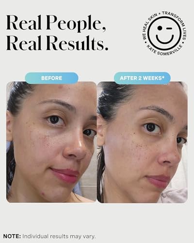 Kate Somerville EradiKate 3% Sulfur Daily Foaming Cleanser Acne Treatment – Clinically Formulated Medicated Face Wash Balances Skin & Cleans Pores, 4 Fl Oz - Image 6