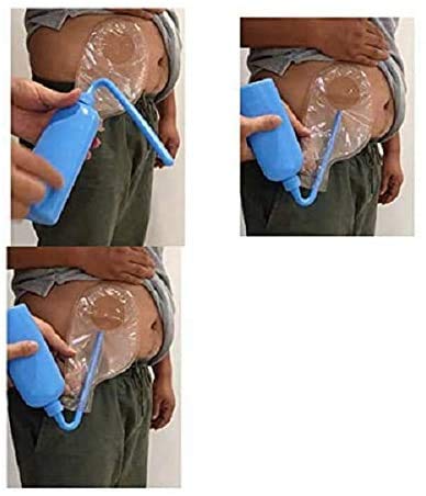 Colostomy Bag Cleaning Tool - Stoma Bag Washing Bottle Rinse Pot For All Ostomy Bags - Reusable Wash Bottle (1Pcs Pz) #TOP2