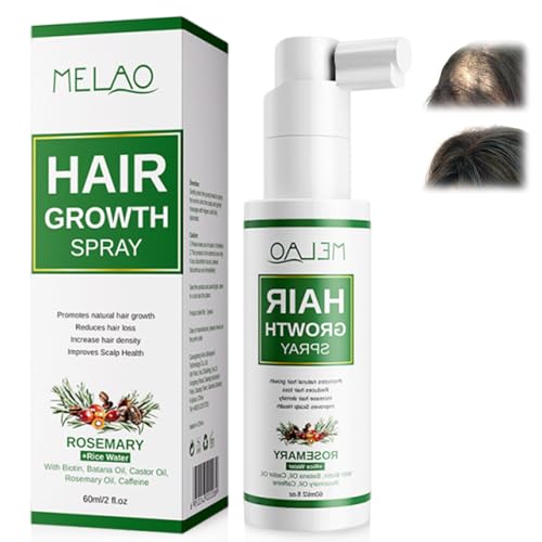 60ml Haarserum gegen Haarausfall,Männer Lösung,Haarpflegeserum Ha...