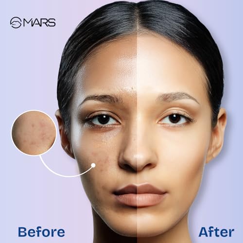 Image of MARS Oil Blotter Gel Compact for Oily Skin with Puff Applicator | Instant Oil Control | Matte Finish Compact | Travel Friendly | For Summers, Weddings, Parties (5.5gm)