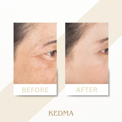 Kedma - Siero Giorno Elixir Arricchito Con Acido Ialuronico E Vitamine A & E - Idratante E Rassodante - 30G - 5