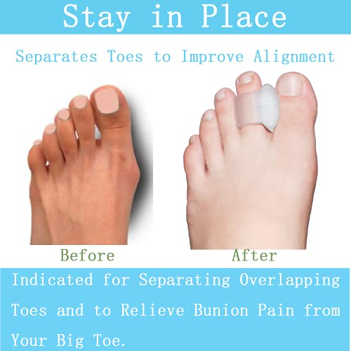 pack of 12 gel toe separator 1434 thick big toe spacers single loop toe spreader for bunions overlapping toe corrector and spacer clear