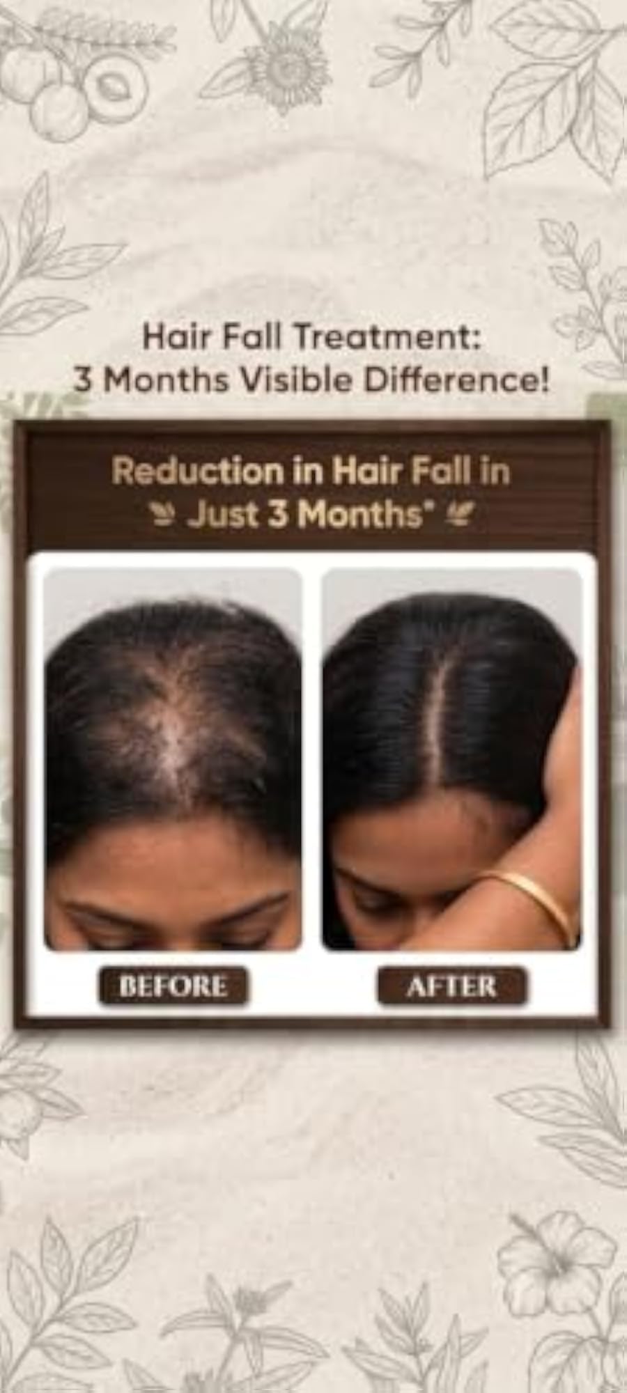 Ayurvedic Hair Oil And Shampoo Combo Kit 100ml