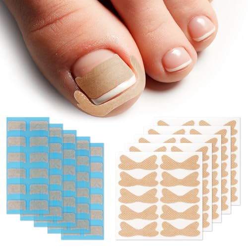 Beugo 110 Pcs Autocollant de Correction des ongles, Correcteur pour Ongles Incarnés, Bandes de...