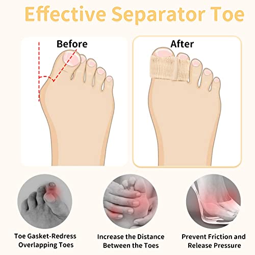 Bunion Toe Separators For Overlapping Toes Women Men,Gel Toe Spacers Bunion Corrector,2 Loops Bunion Corrector For First Two Toes (12Pc) #TOP2