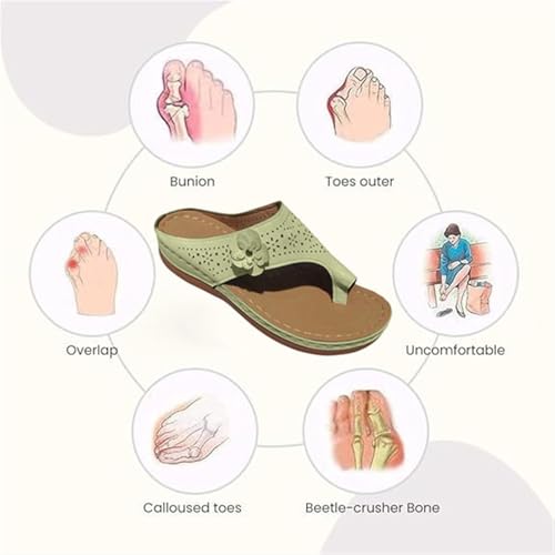CLSQLXYJZC Bunion Correction Leather Open Toe Sandals, Women's Comfortable Platform Slip-On Flower Orthopedic Bunion Sandals, Orthotic Flip Flops, for Bunion Splints Toe Separator4