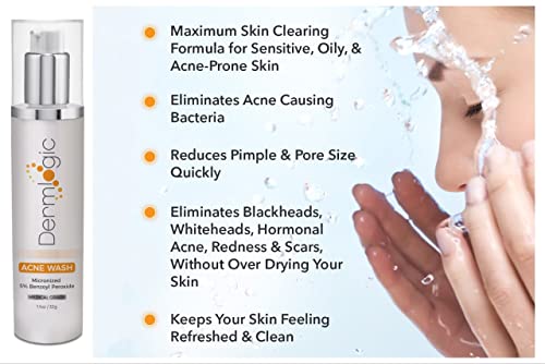 Acne Treatment- 5% Benzoyl Peroxide Face & Body Wash- Penetrates Deep Within Pores To Immediately Fight Zits To Clear Skin. Eliminates And Prevents New Pimples From Forming. #TOP6