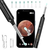 VITCOCO Ear Wax Removal, Wireless Ear Cleaner with 1296P HD Ear Camera Ear Otoscope, Earwax Removal