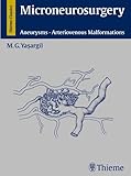 Microneurosurgery: Aneurysms, Arteriovenous Malformations