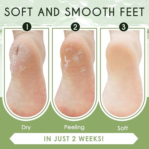 Foot Peel Mask 2 Pairs(Avocado + Aloe vera),Exfoliating foot skin mask is suitable for hard skin,peeling socks, A gift for women and men,Gentle and Moisturizing formula, Remove dead skin and repair he - Image 6