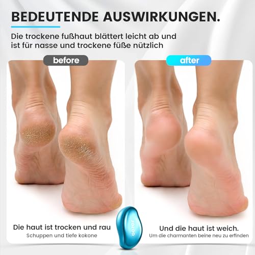 BEZOX Eliminador de callos de cristal nano 2 en 1 – eficaz Nano Glass – Pedicura profesional – Lima Premium para callos - imagen 3