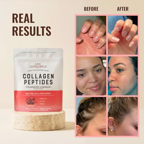 Image of Live Conscious Collagen Peptides Powder - Strawberry Lemonade - Type I & III for Hair, Skin, Nails & Joint Support - Hydrolyzed, Grass-Fed Bovine - Women & Men, 30 Servings - 12.8oz