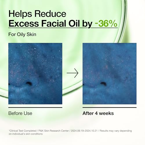 30% Off Anua Azelaic Acid Serum for Blemish-Prone Skin