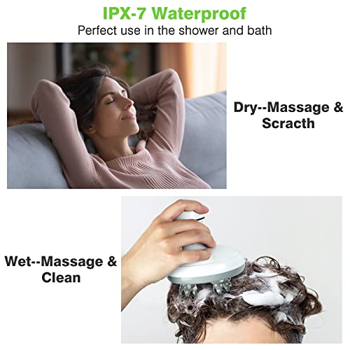 Cotsoco Scalp Massager Electric Head Scratcher,Handheld Head Massager With Charging Base For Hair Growth, Stress Relief And Deep Cleaning, Waterproof Head Massage With Kneading 84 Massage Nodes #TOP4