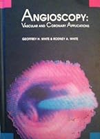 Angioscopy: Vascular and coronary applications 0815193327 Book Cover