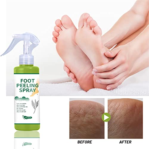 3 Pcs Esfoliante para os pés, Natural Hidratante Chá Verde Peeling Spray Removedor de Calosidades, S