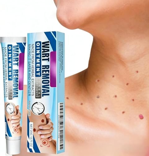 1/2/3PCS Fibromi Penduli Rimozione,Verruche Rimozione,Crema Per Eliminare Fibromi Penduli,Crema Levigante Viso Corpo Mani Piedi (1PCS)