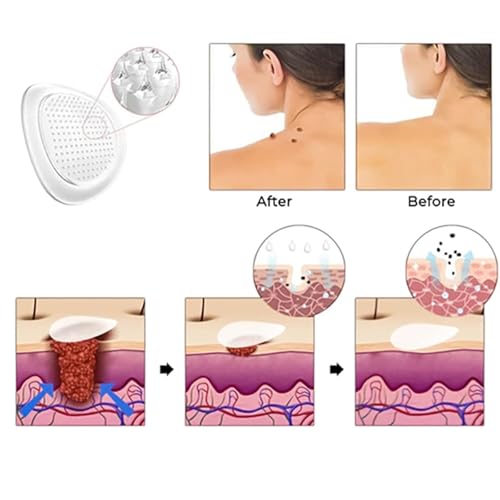 Image of DermaSmooth Skin Tag Patches | Invisible Adhesive Spot Covers for Face, Neck & Body | Gentle Skin Care Patch Sheets (White color) (144 Patches)