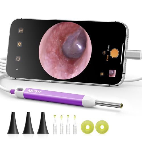 Anykit Ear Wax Camera Otoscope – Type-C, 6 LED Lights