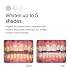 Opalescence 20% Teeth Whitening Refill Kit (4 Syringes) Carbamide Peroxide. Made by Ultradent, in Mint Flavor. Tooth Whitening Refill Syringes - B-5196-4