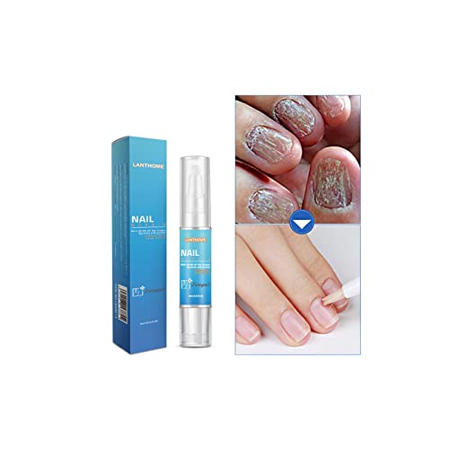 Strength Nail Repair Pen, Clean Toenails Effective Toenail And Nail Care, Nail Repair Gel Pen, Toe And Finger Nail Strengthener, Fixes And Repairs Damaged Brittle Nails #TOP7