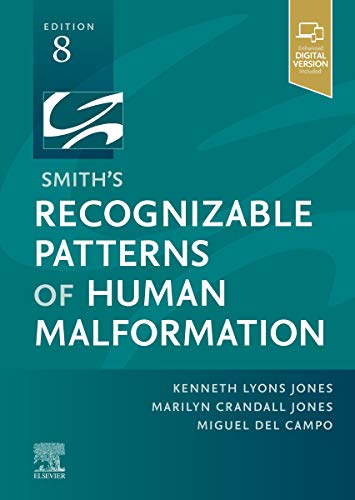 Smith's Recognizable Patterns of Human Malformation - E-Book: Expert Consult - Online and Print Smith's Recognizable Patterns of Human Malformation - E-Book: Expert Consult - Online and Print