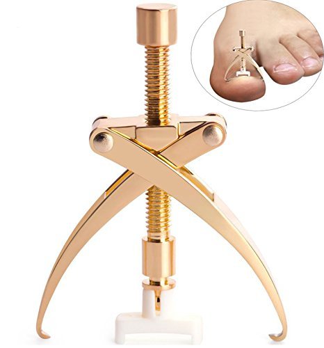 Ingrown Toe Nail Correction Tool Toenail Treatment Pedicure Tool Ingrown Toenail Treatment Kit