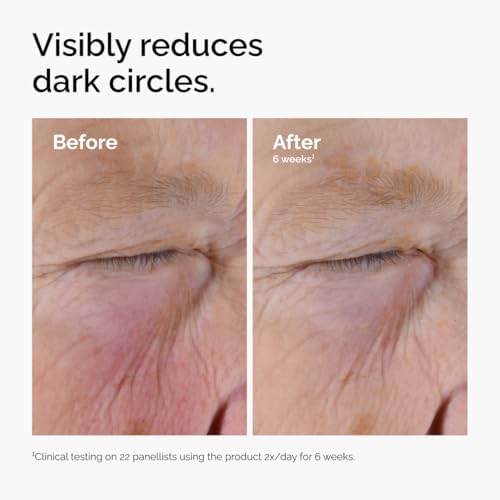 The Ordinary Caffeine Solution 5% + EGCG Eye Serum, Depuffing Eye Serum for Dark Circles and Tired Eyes, 30 ml