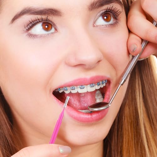 Image of 100 Pcs Interdental Brushes, 5 Sizes Braces Flossers for Cleaner Braces Brush Soft Dental Brushes Toothpicks Dental Floss Picks Dental for Braces Oral Cleaning(5 Colors)