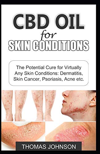 CBD Oil for Skin Conditions: The Potential Cure for Virtually Any Skin Conditions: Dermatitis, Skin Cancer, Psoriasis, Acne etc.