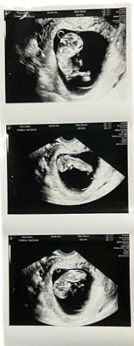 Personalized Pregnancy Prank Ultrasound Photos | Customized Ultrasound Positive Test Results Strip of 3 Photos from real ultrasound printer | Hilarious Gag gift for friends and family