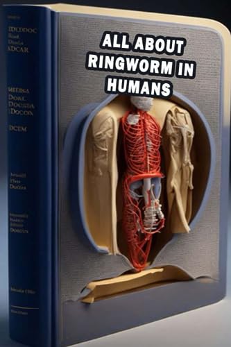 All About Ringworm In Humans: Discover Ringworm In Humans - Causes, Symptoms, and Treatment for Fungal Infection!