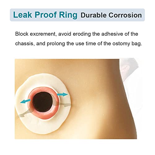 Ostomy Barrier Rings No Leaking Barrier Extenders For Colostomy Bags Pack Of 20 #TOP6