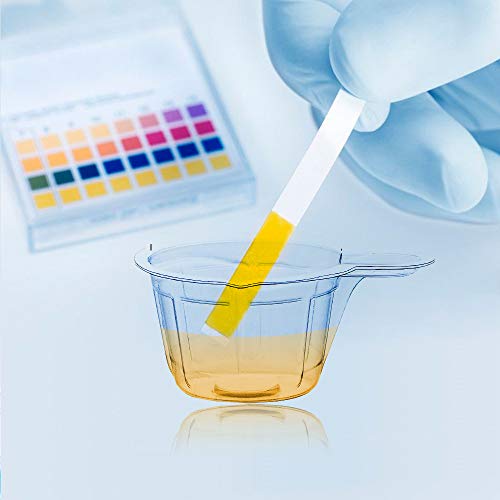 Shjykru 40Ml Plastic Disposable Urine Cups - 80/120/200 Pcs Easy To Collect Urine Specimen Cups For Pregnancy Test/Ovulation Test/Ph Test (80) #TOP3