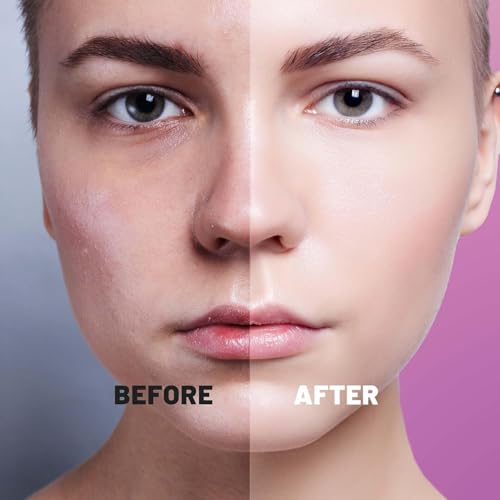 Image of TOLEVITA Bio-Collagen Hydrogel Face Mask - Hydrating & Nourishing Mask with Niacinamide, Galactomyces & Hyaluronic Acid - 6 Pack, Improves Elasticity & Softens Skin (White)