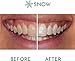 Snow Extra Strength Teeth Whitening Gel Refill - Teeth Whitening Pen, Teeth Whitening at Home Stick Refills, Tooth Serum Wand for Whitening & Oral Care, Easy to Use Teeth Whitener Stick - Pack of 1 Snow Extra Strength Teeth Whitening Gel Refill - Teeth Whitening Pen, Teeth Whitening at Home Stick Refills, Tooth Serum Wand for Whitening & Oral Care, Easy to Use Teeth Whitener Stick - Pack of 1