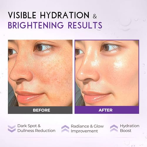 RAWQUEST Intense Brightening Serum 50 ml – 5% Niacinamide, 2% Tranexamic Acid, 2% MadeWhite, Alpha-Arbutin for Dark Spot Reduction, Brightening Radiant Glow Boost, Dull Uneven Skin Improvement, Hydration