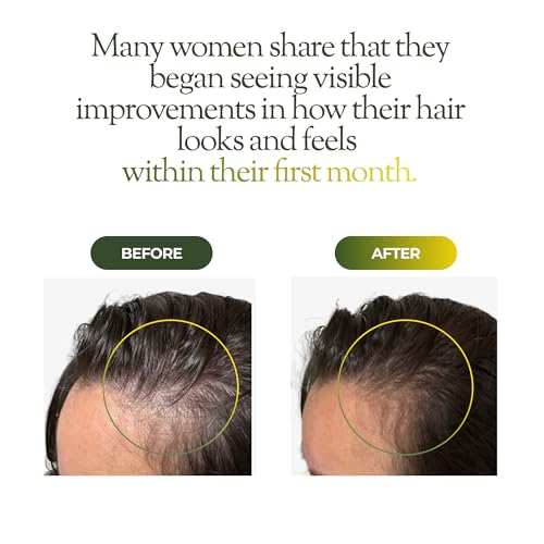 Regener8 Hair & Scalp Oil for Women 1oz — view 3