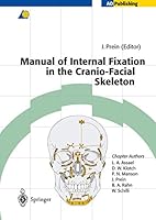Algopix Similar Product 10 - Manual of Internal Fixation in the