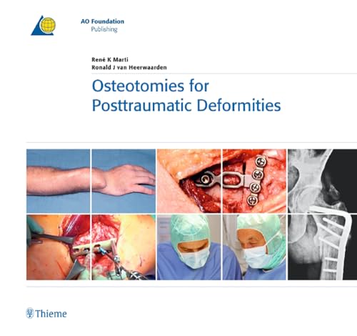 Osteotomies for Posttraumatic Deformities (AO-Publishing)