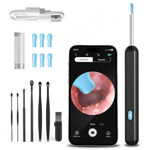 Image of Smart Ear Cleaner with Camera for Ear Wax Removal, HD Visual Ear Pick, Temperature Control, Rechargeable Type-C, Family Use