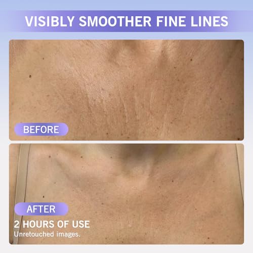 Image of Neck Wrinkle Patches, Reusable Silicone Pads for Chest and Decollete, Overnight Smoothing and Firming, Anti Aging for Fine Lines, Washable Soft Fit, Side Sleeper Support, Anti Wrinkle Pads 4-Pack
