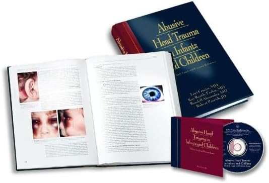 Abusive Head Trauma in Infants and Children: A Medical, Legal, and Forensic Reference (Book & CD-ROM)