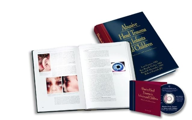 Abusive Head Trauma in Infants and Children: A Medical, Legal, and Forensic Reference (Book & CD-ROM)