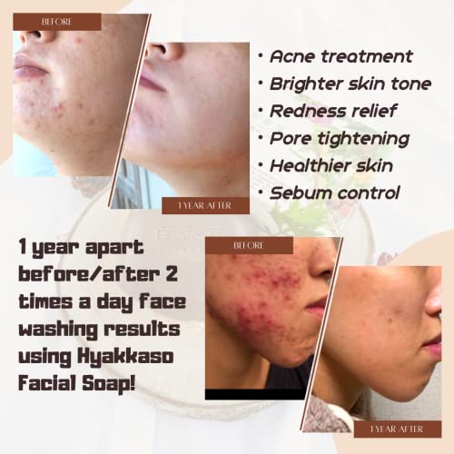 Hyakkaso Japan - Herbs & Minerals Facial Soap, Daily Cleansing And Acne Care, For All Skin Types, Face And Body Wash, Japanese Skincare 80G 2.8Oz #TOP7
