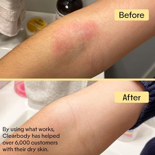 Clearbody Manuka Honey Eczema Cream – Organic Honey & Collodial Oatmeal Moisturizer for Soothing, eczema, Dry & Itchy Skin – Face & Body Lotion - Plant-Based Formula (4oz) - Thumbnail 6